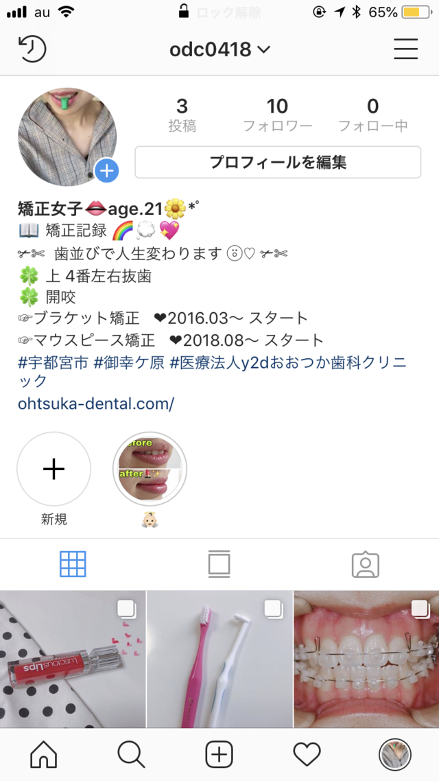 Instagram(矯正用)